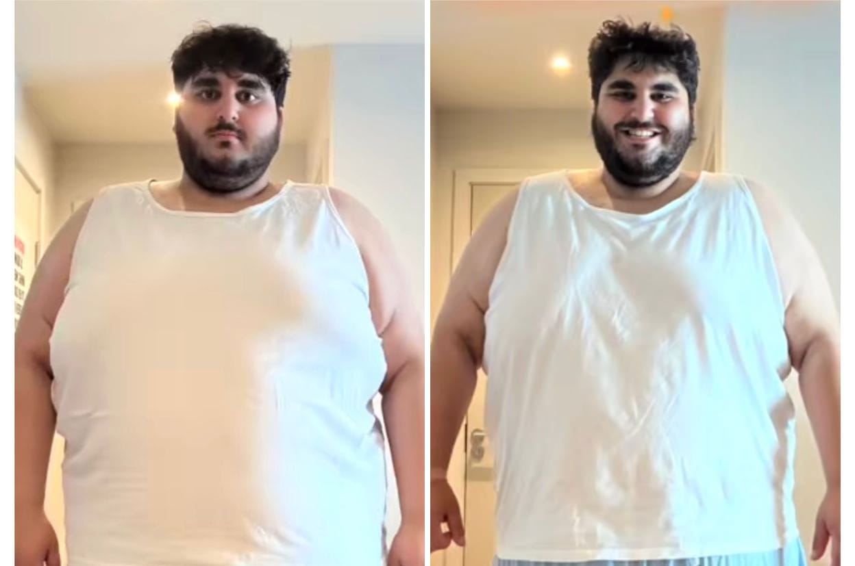 Daud before and after